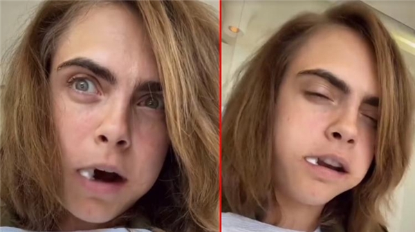  <a class='keyword-sd' href='/cara-delevingne/' title='Cara Delevingne'>Cara Delevingne</a>, operasyon koltuğundan seslendi: Çok ağladım