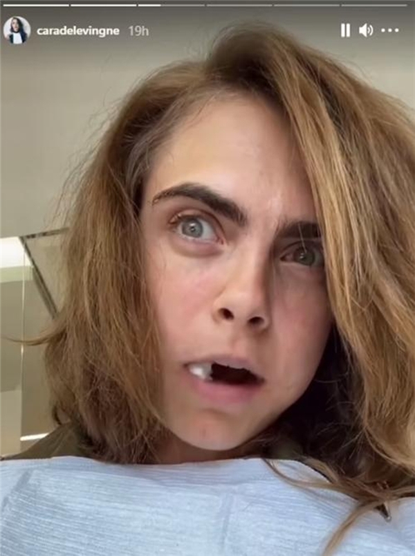 Cara Delevingne, operasyon koltuğundan seslendi: Çok ağladım