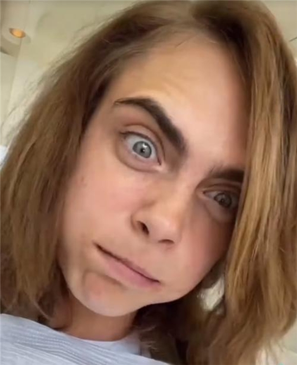 Cara Delevingne, operasyon koltuğundan seslendi: Çok ağladım