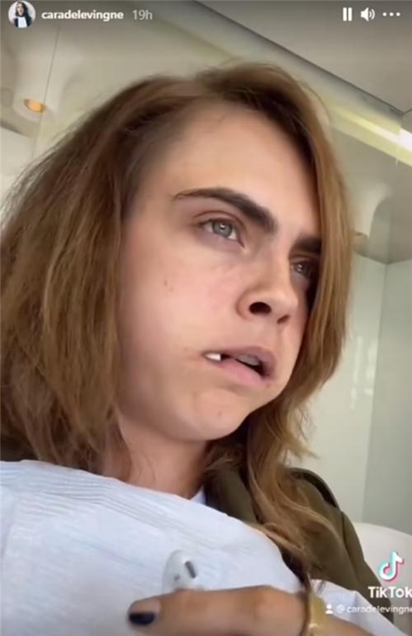 Cara Delevingne, operasyon koltuğundan seslendi: Çok ağladım