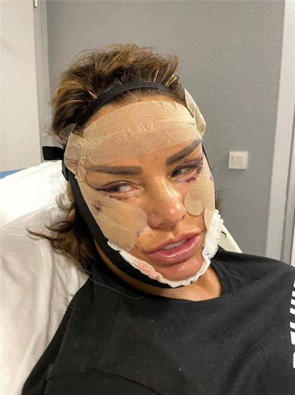 Katie Price estetiğe doyamıyor, eski kocası kızdı: Bari biraz çocuklarını düşün!