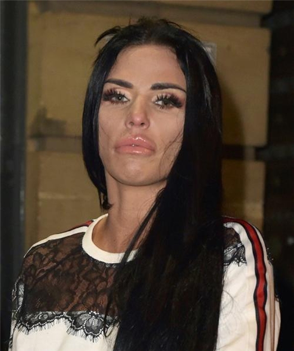 Katie Price, estetik operasyon videolarından para kazanıyor