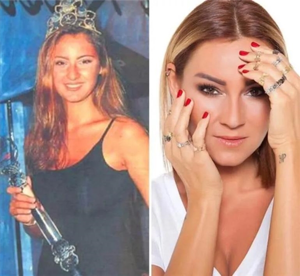Miss Turkey'de 'estetikli' güzel tartışması: 'Eskiden dişini yaptırsa elenilirdi'