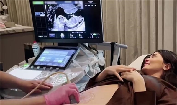 Kylie Jenner ve Travis Scott mutlu haberi sosyal medyadan duyurdu: Yeni bebek geliyor