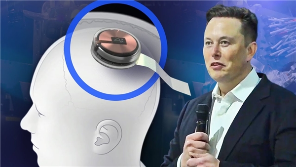 Elon Musk'ın Neuralink Girişimi Yasal Sorunlarla Karşı Karşıya