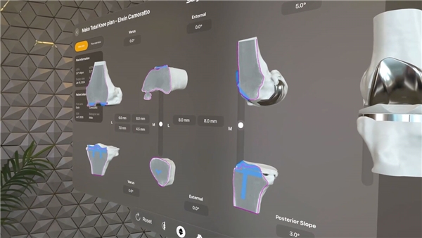 Apple Vision Pro, İngiltere'de bir ameliyatta kullanıldı